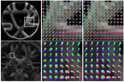 hlawitschka2013Tractography